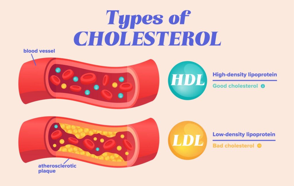 Is Pizza High in Cholesterol? the Ultimate Guide